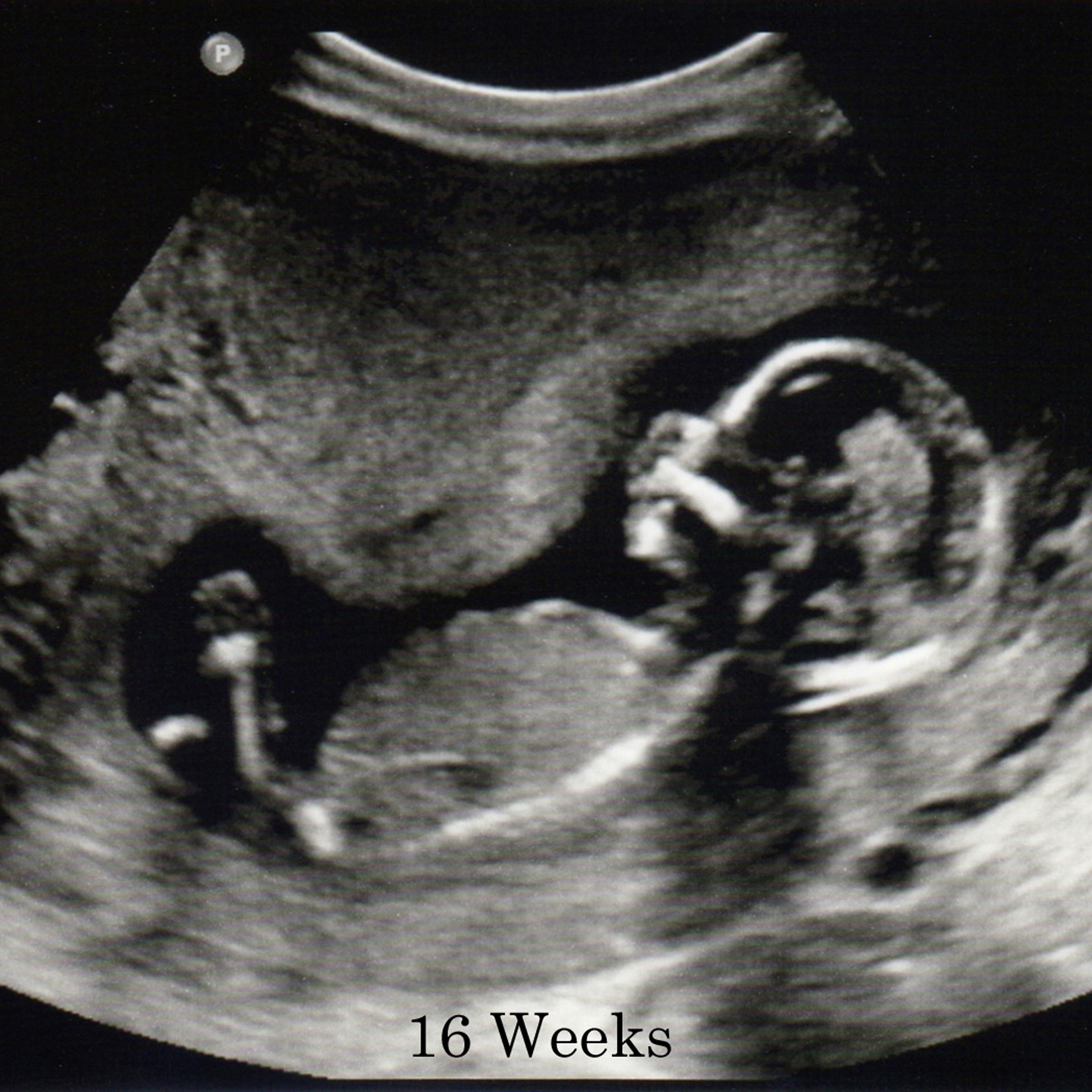 16 Weeks Gestation